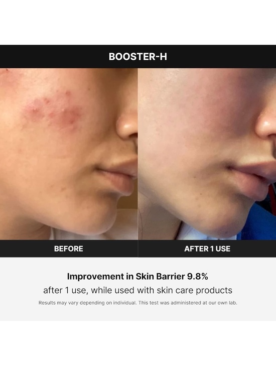 Medicube Age-R Booster H - Picture 3 of 4